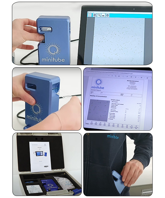 AndroScope移動精液分析儀